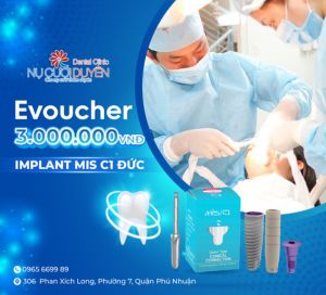 Nu Cuoi Duyen Voucher
