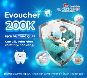 Nu Cuoi Duyen Voucher